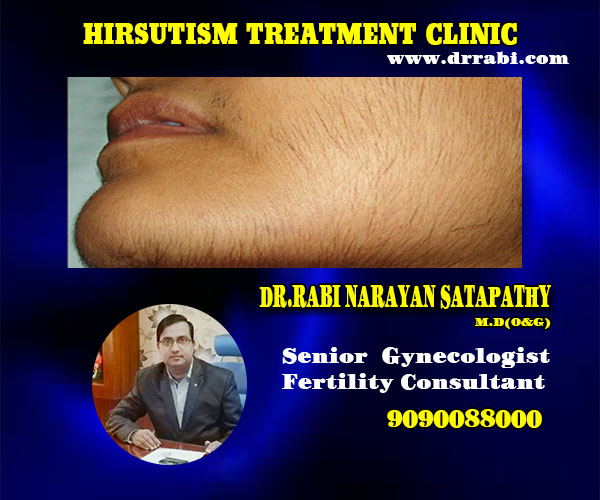 best hirsutism treatment clinic in bhubaneswar near capital hospital - dr rabi
